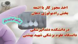 اخذ مجوز کار با اشعه